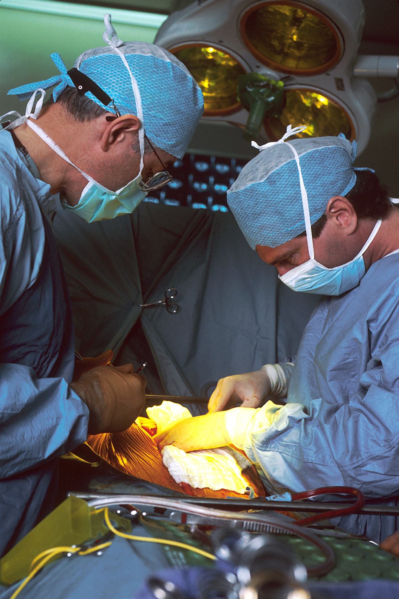 Surgical team in an operating theatre using disposable protective equipment